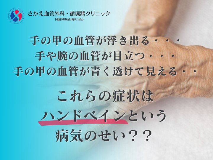 手や腕の血管が浮き出るのはハンドベインという病気？原因や直し方について解説！￼